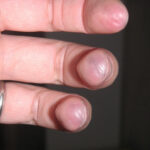 Guitar player's calloused fingers close-up