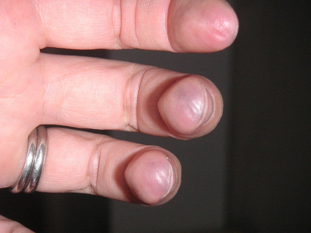 Guitar player's calloused fingers close-up